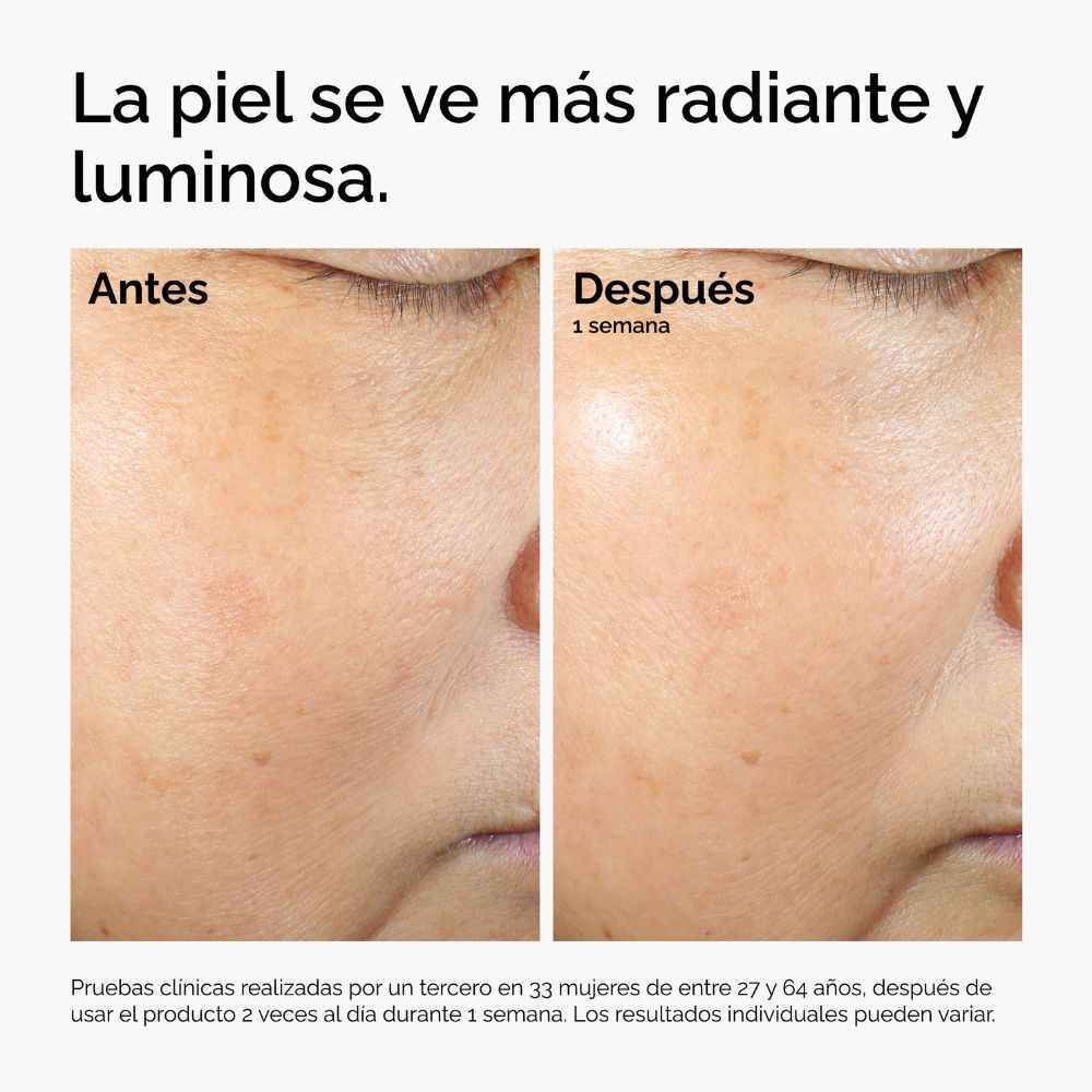 RICE LIPIDS + ECTOIN MICROEMULSION (MICROEMULSI&Oacute;N DE ECTO&Iacute;NA + L&Iacute;PIDOS DE ARROZ)